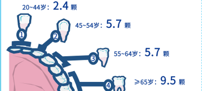 口腔种植界的 “GPS 钉子”：导板再也不 “跑偏”